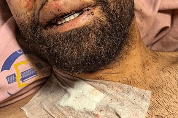 افراد حاضر در اغتشاشات این‌طوری کشته شدند