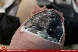 مرگ سه نفر در حوادث چهارشنبه آخر سال