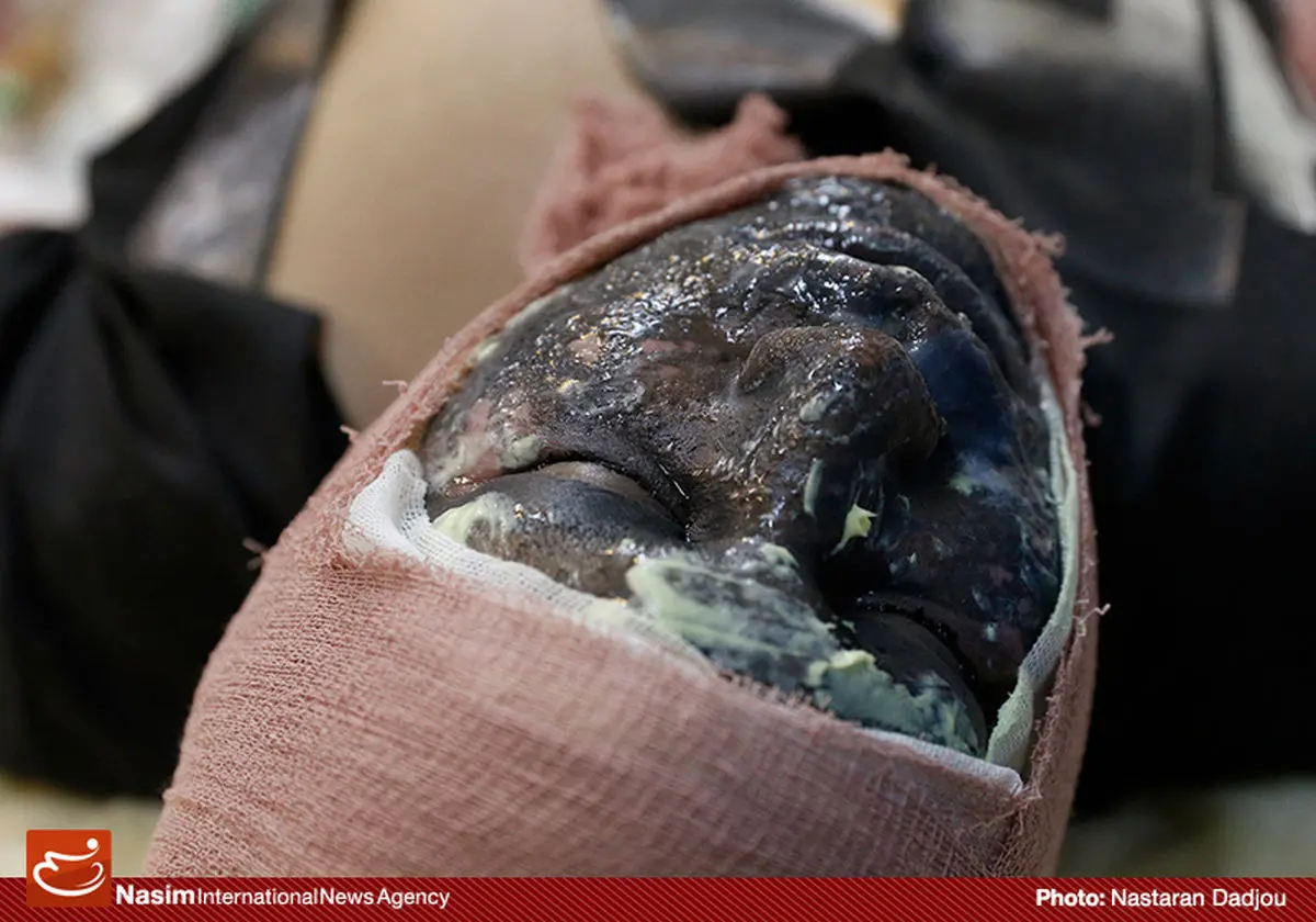 مرگ سه نفر در حوادث چهارشنبه آخر سال