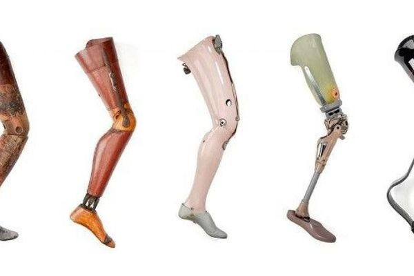پروتز پای مصنوعی هوشمند ، راهی ارزان قیمت برای بازگشت به زندگی