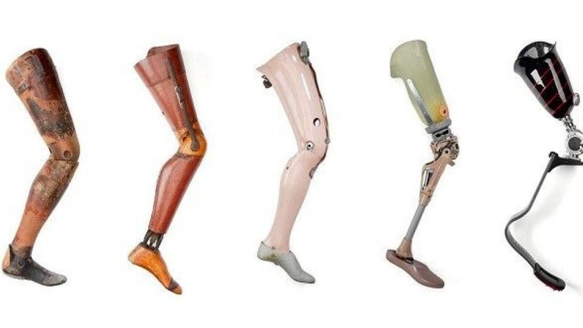 پروتز پای مصنوعی هوشمند ، راهی ارزان قیمت برای بازگشت به زندگی
