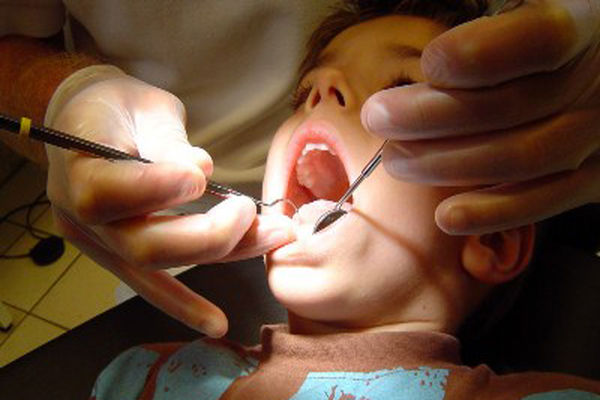 ارزش نسبی خدمات دندانپزشکی در شورای عالی بیمه تعیین شد