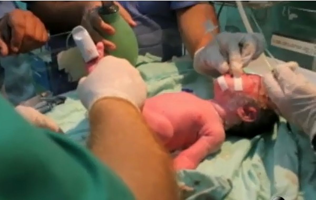 یک نوزاد فلسطینی در غزه پس از شهادت مادرش متولد شد + تصاویر