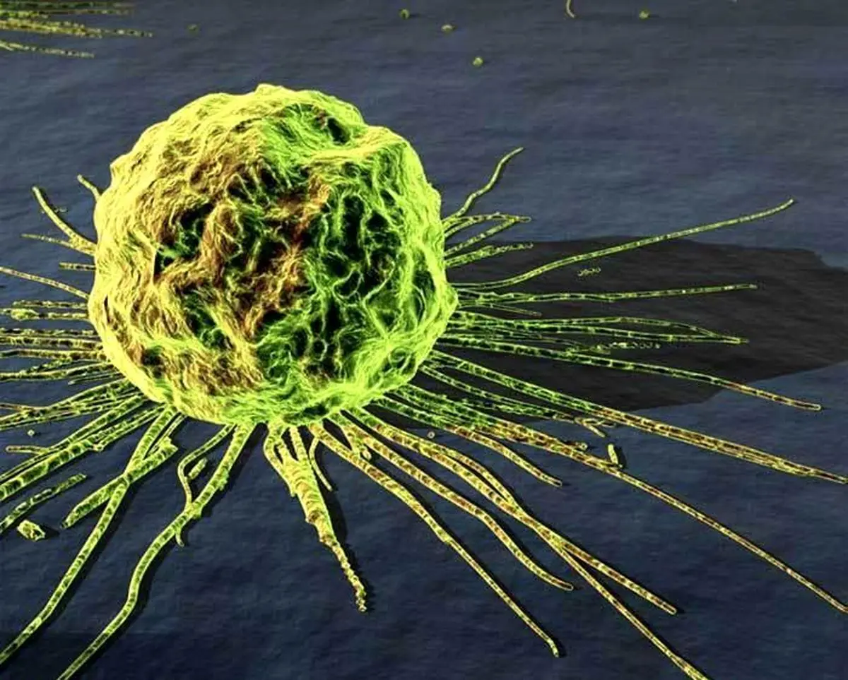 "پیشگیری مهمترین موضوع در مواجه با بیماری سرطان است"