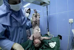 نماینده صندوق جمعیت سازمان ملل: ایران موفق به کاهش ۸۰ درصدی مرگ ومیر مادران شده است