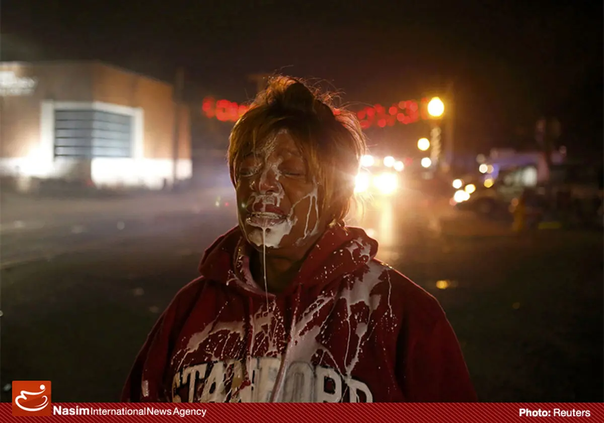 یک معترض آمریکایی پس شلیک گلوله پلاستیکی پلیس به صورت وی به کما رفت