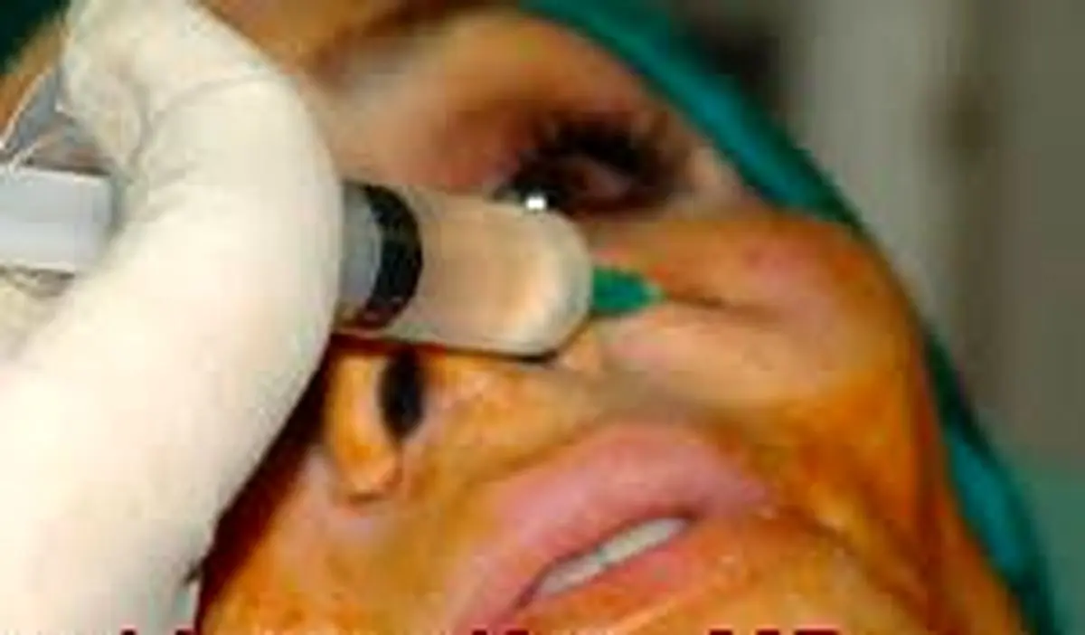 ۹۵ درصد شکایات مرتبط با خدمات پوست، به فعالیت پزشکان عمومی و آرایشگرها بر می‌گردد