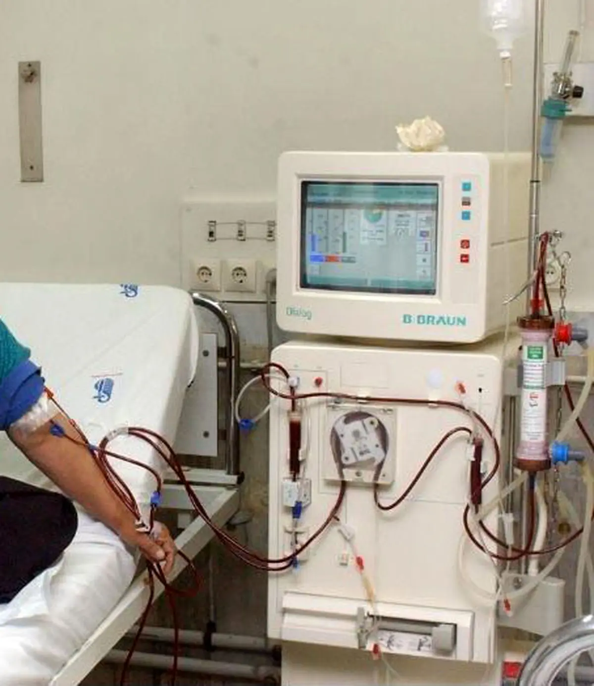 نخستین مرکز همودیالیز وقفی کشور احداث می شود