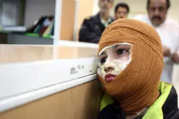 رئیس چهارمین همایش کشوری سوختگی: هیچ مرکزی زیر بار ایجاد مرکز سوختگی نرفته است