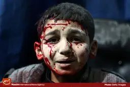 گزارش تصویری::کودکان آواره جنگ نیابتی آمریکا در عراق و سوریه