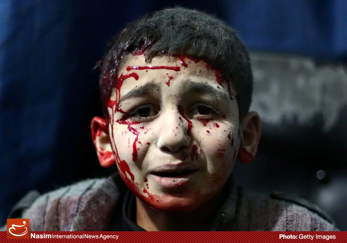 گزارش تصویری::کودکان آواره جنگ نیابتی آمریکا در عراق و سوریه