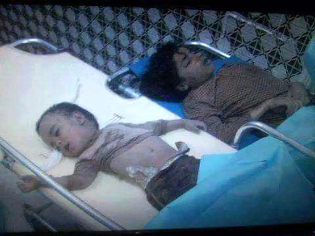 تعداد  شهدای کودک در یمن به ۱۸۰ نفر رسید