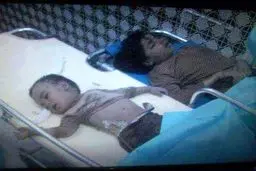 سازمان ملل از استفاده عربستان از بمب‌های خوشه‌ای علیه مردم یمن خبر داد