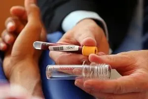 تست دوپینگ یک دوومیدانی کار نوجوان مثبت اعلام شد