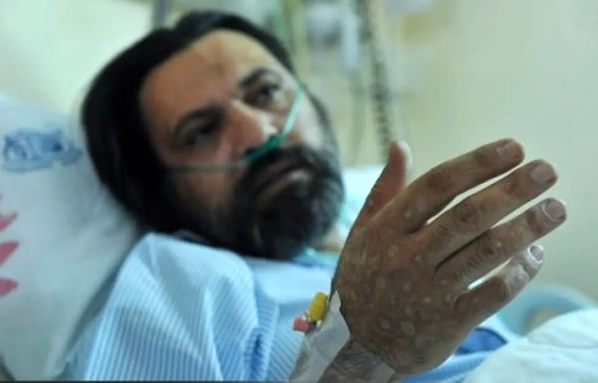 "رضا ایران‌منش" زیر تیغ جراحی رفت