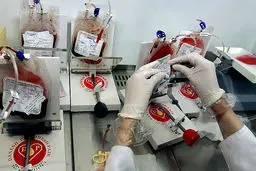 بانک عمومی خون بند ناف در آستانه تعطیلی