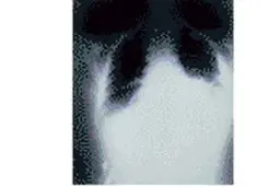 آمریکا بیماری سیاه زخم را در جهان منتشر کرد