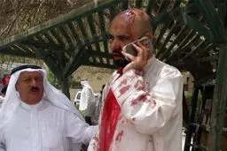 بیش از ۲۵ نفر در انفجار مسجد شیعیان کویت کشته و زخمی شدند + تصاویر