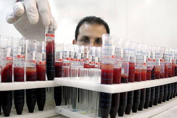 سازمان انتقال خون ایران با انجمن علوم آزمایشگاهی تفاهم‌‌نامه امضا کرد