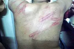 زندان‌های بحرین شکنجه‌گاه مخالفان آل‌خلیفه؛ شکنجه بیش از ۳۵۰۰ زندانی بحرینی