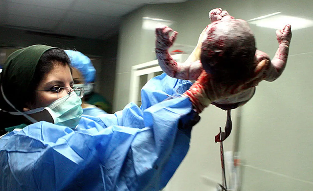 کاهش ۵.۵ درصدی  سزارین در سال ۹۳