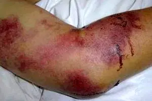 سازمان دامپزشکی: بیماری 