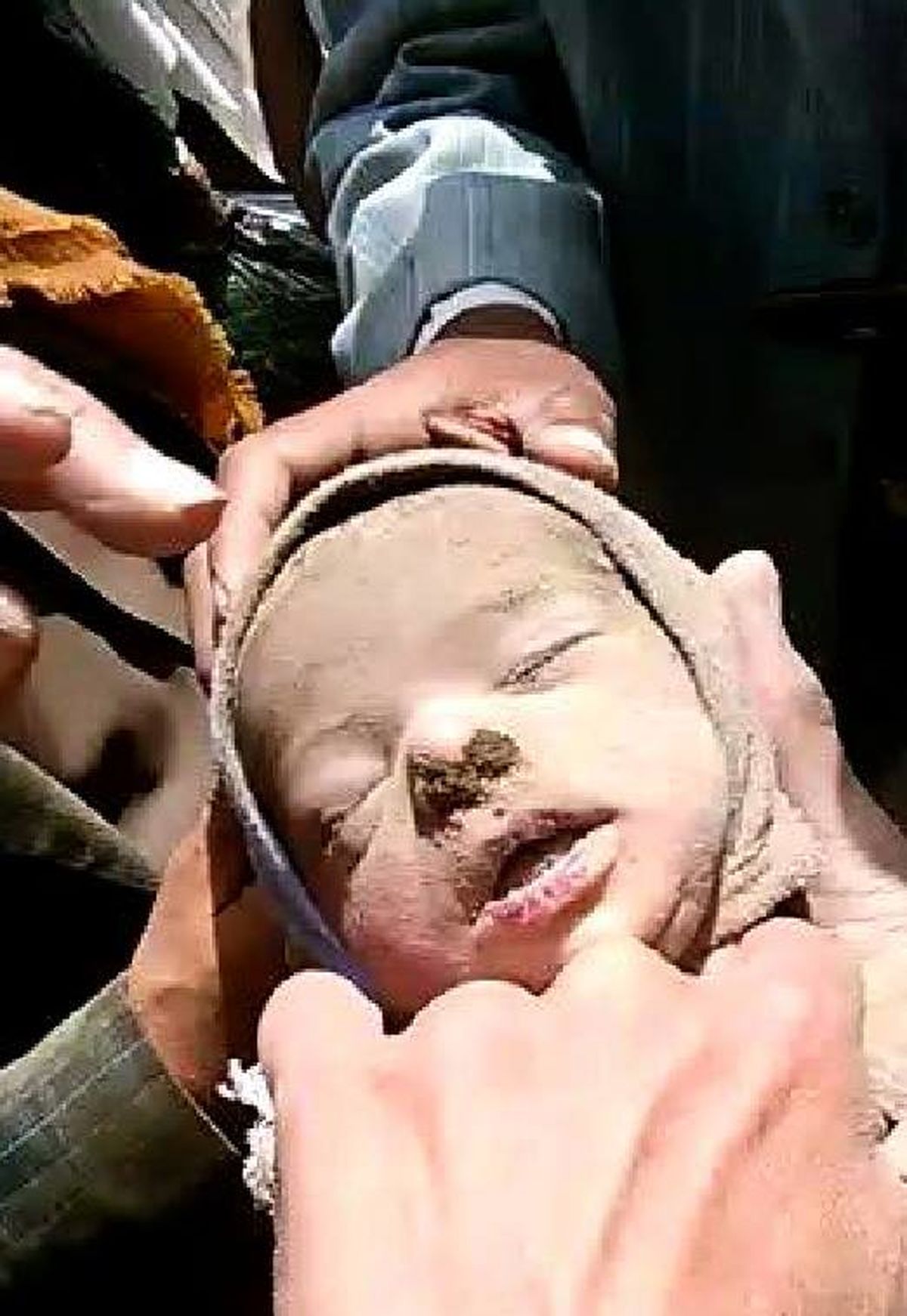 شهادت "دردناک" کوچکترین یمنی قربانی  جنایات سعودی‌ها + تصاویر