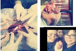 معاون آموزشی وزارت بهداشت: سلفی با اجساد ممنوع است