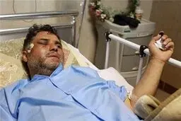 نایب رئیس مجلس و برخی نمایندگان از خبرنگار مجروح صداو سیما  عیادت کردند