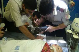 چرخ گوشت،  سه انگشت دست چپ یک کودک دو ساله را بلعید