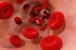 راه پیشگیری از ابتلاء به 