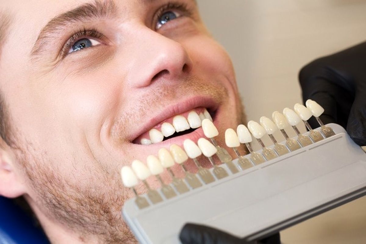 آشنایی با انواع خدمات زیبایی و درمان های دندانپزشکی
