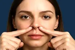 جراحی آلارپلاستی: کاربردها، مزایا و نکات مهم قبل از عمل