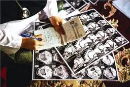 نبض پزشک خانواده کند می‌زند