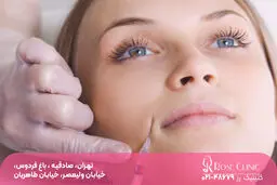 بهترین کلینیک تزریق مزوژل در تهران کجاست؟